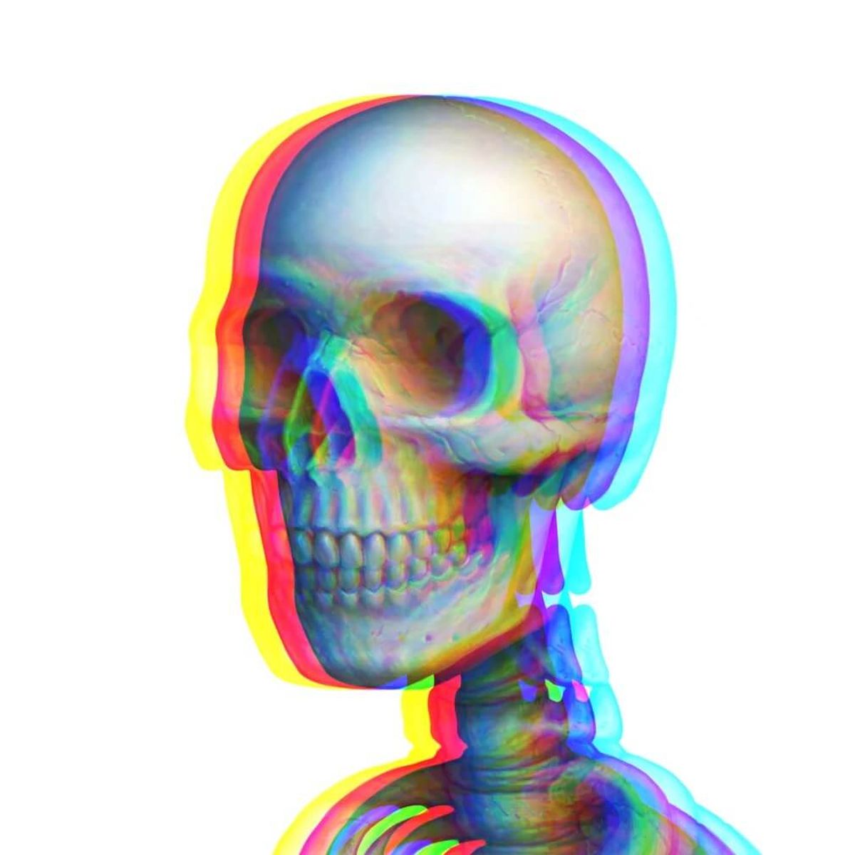 Skellie (Printing Error)