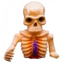 Broken Bones