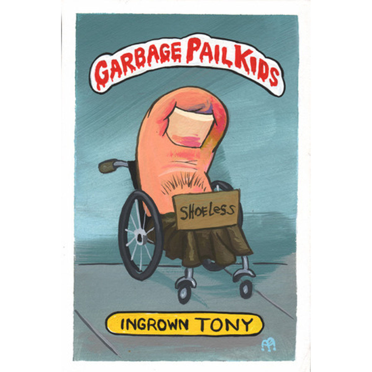 Ingrown Tony