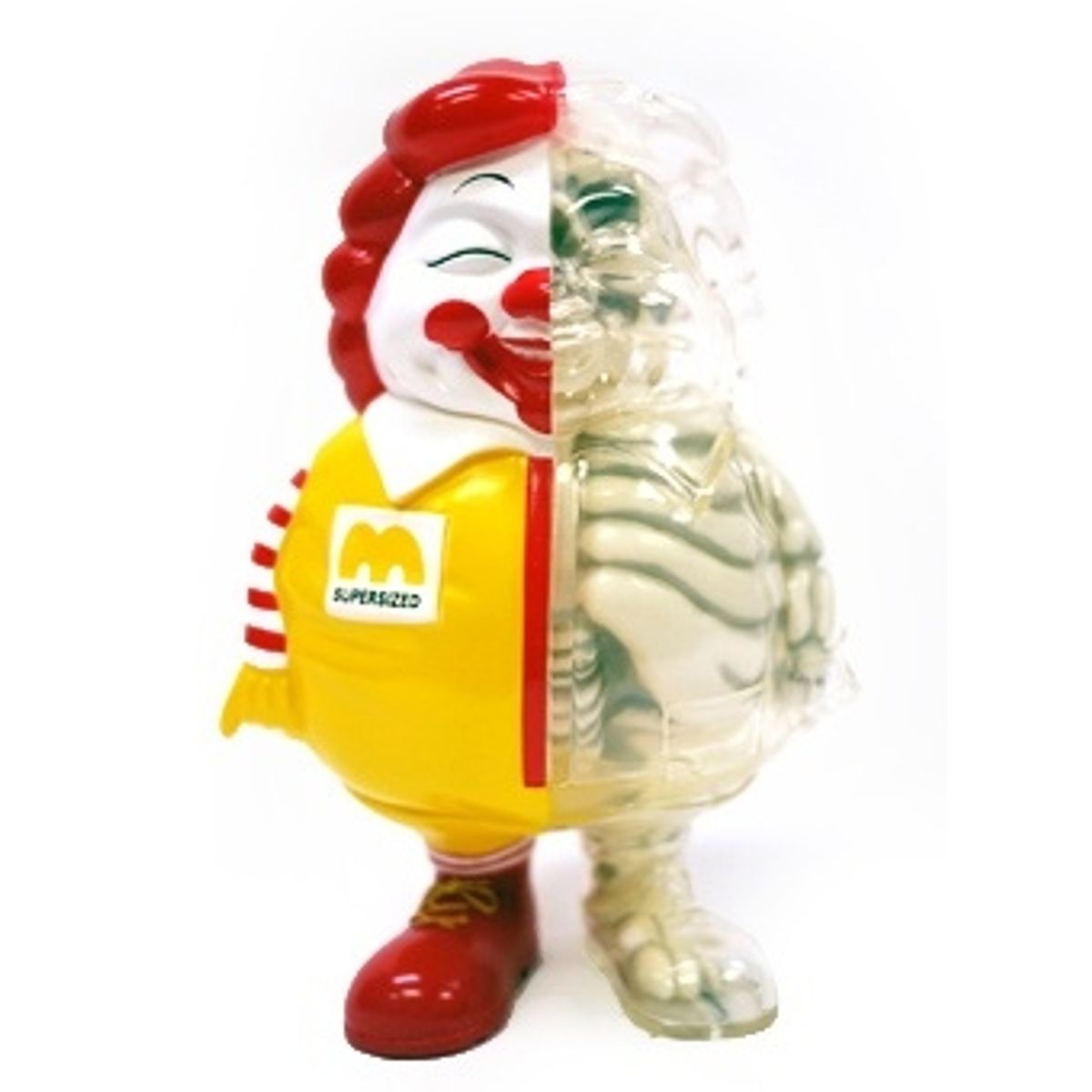 X-Ray MC Supersized - 1st Edition