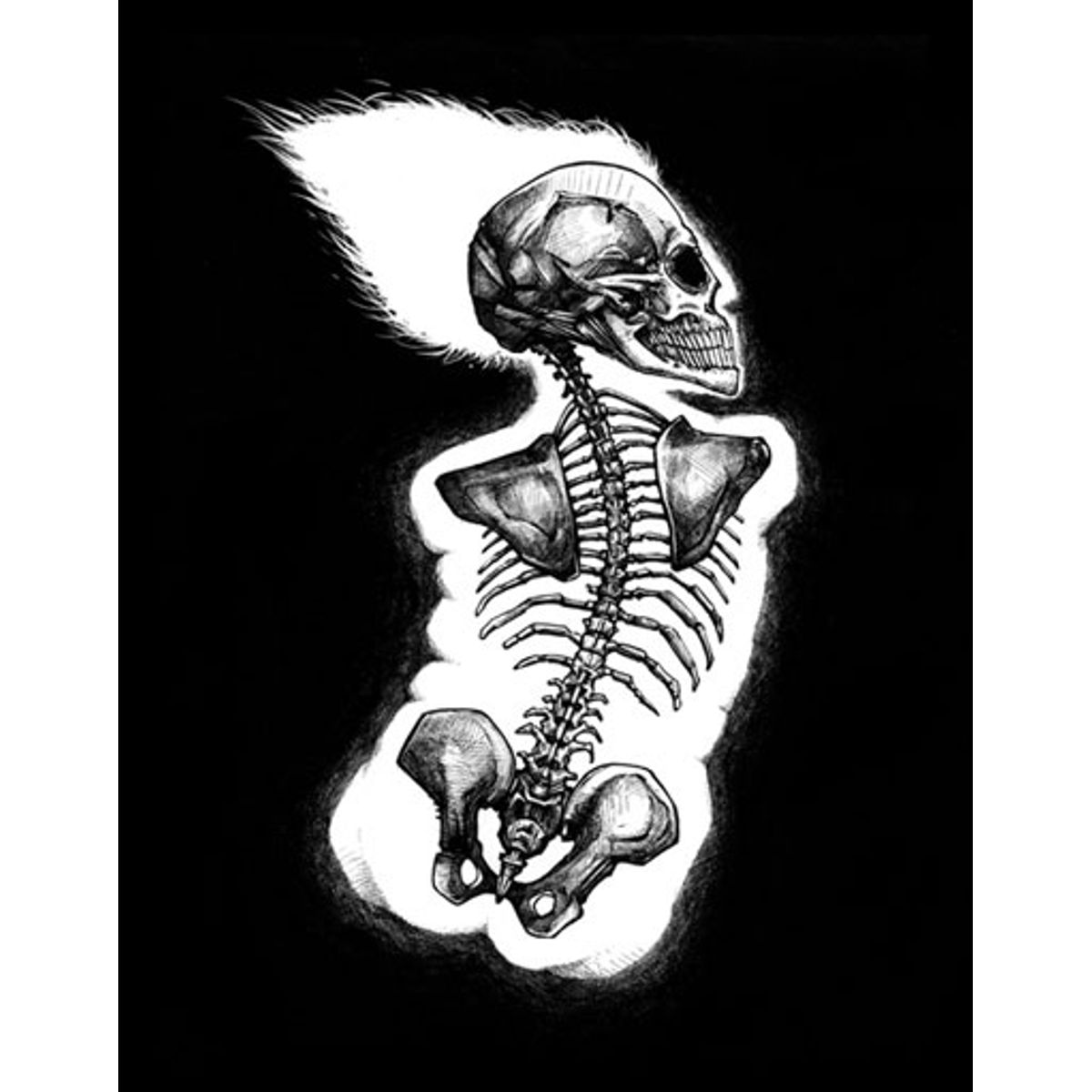X-Ray