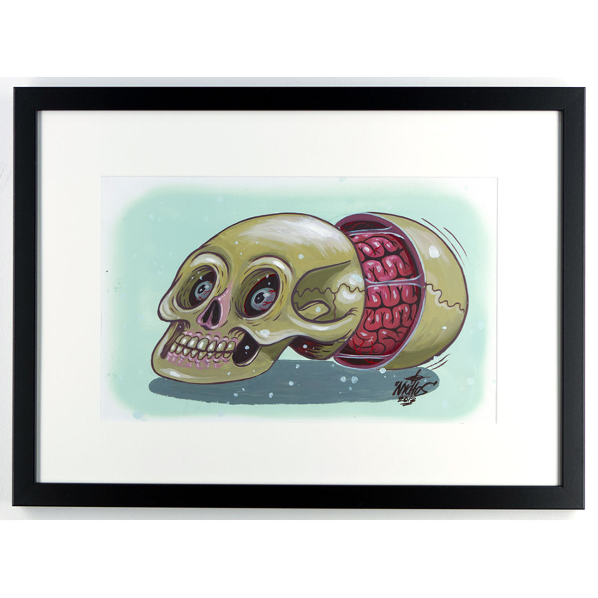 Dissection of a Disordered Human Skull