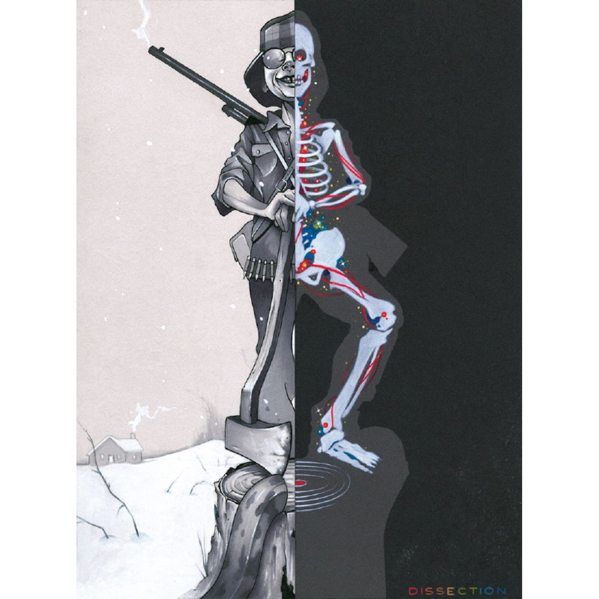 Hunter Dissection