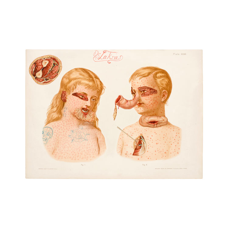 Untitled (Case Notes with Snake) by Dr. Larka