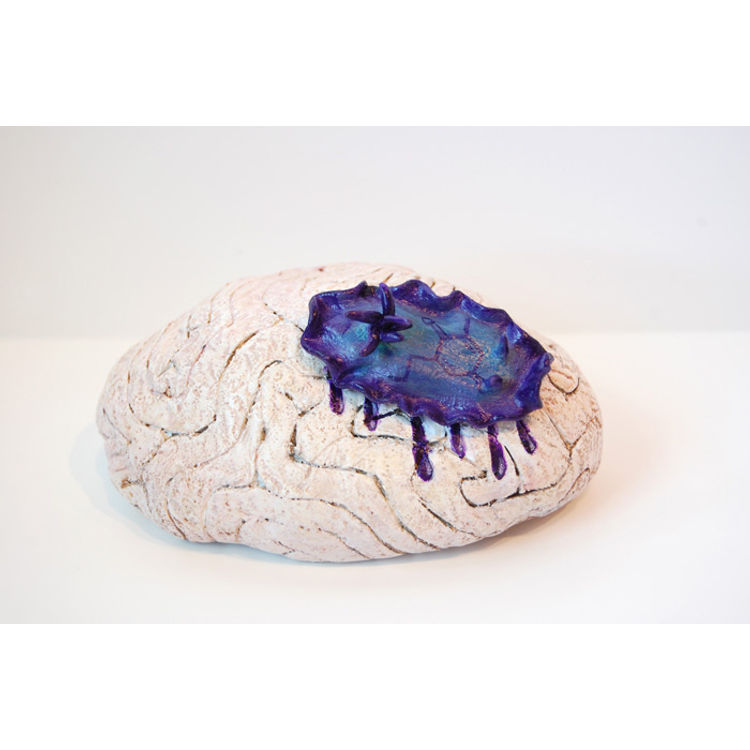 Brain Coral by Katie Carillo