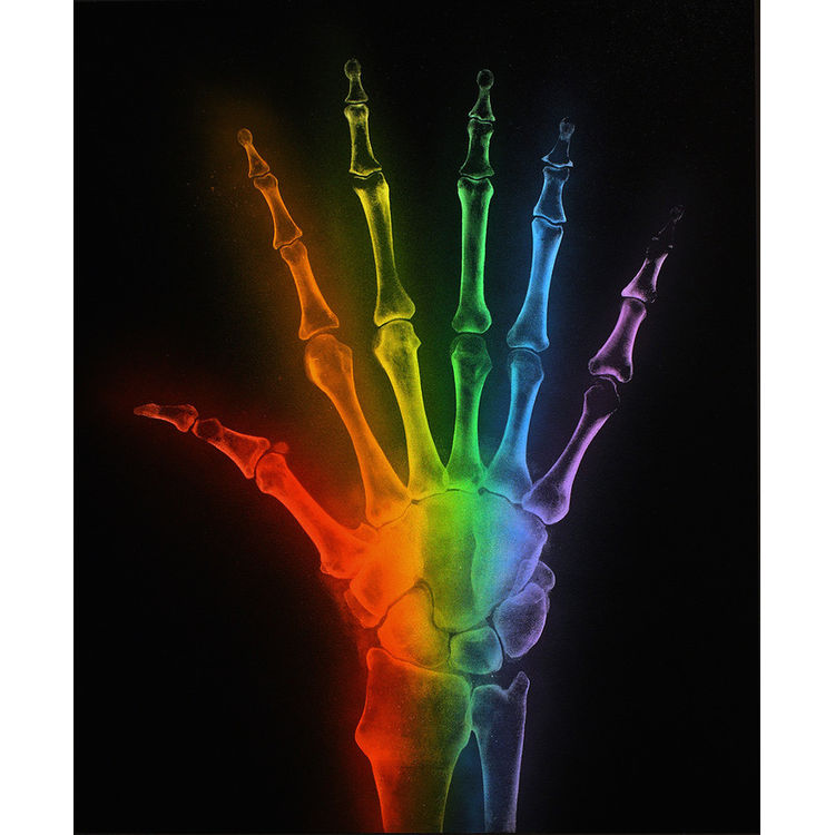 ‘Difference’ print by Shok-1