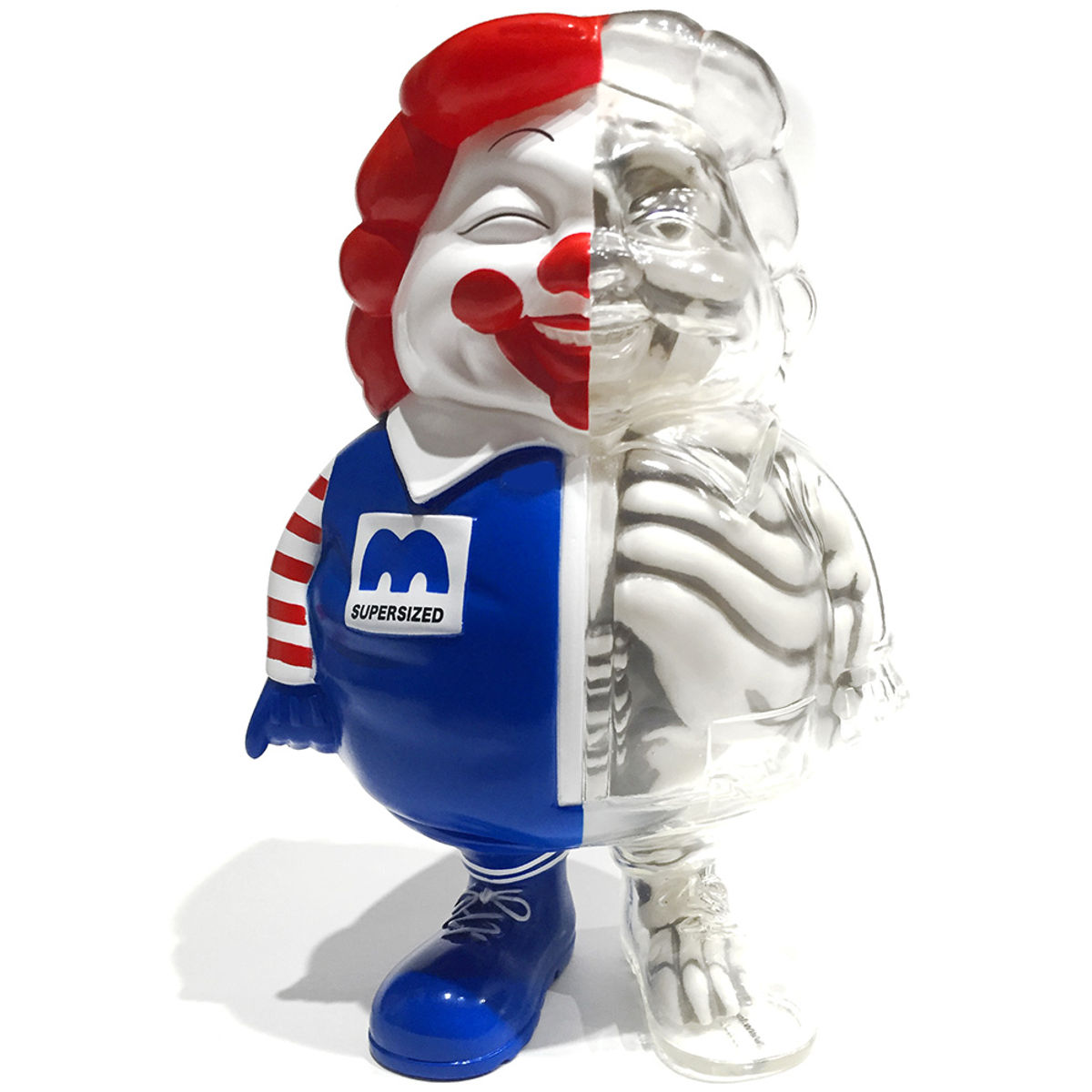 X-Ray Mc Supersized CA