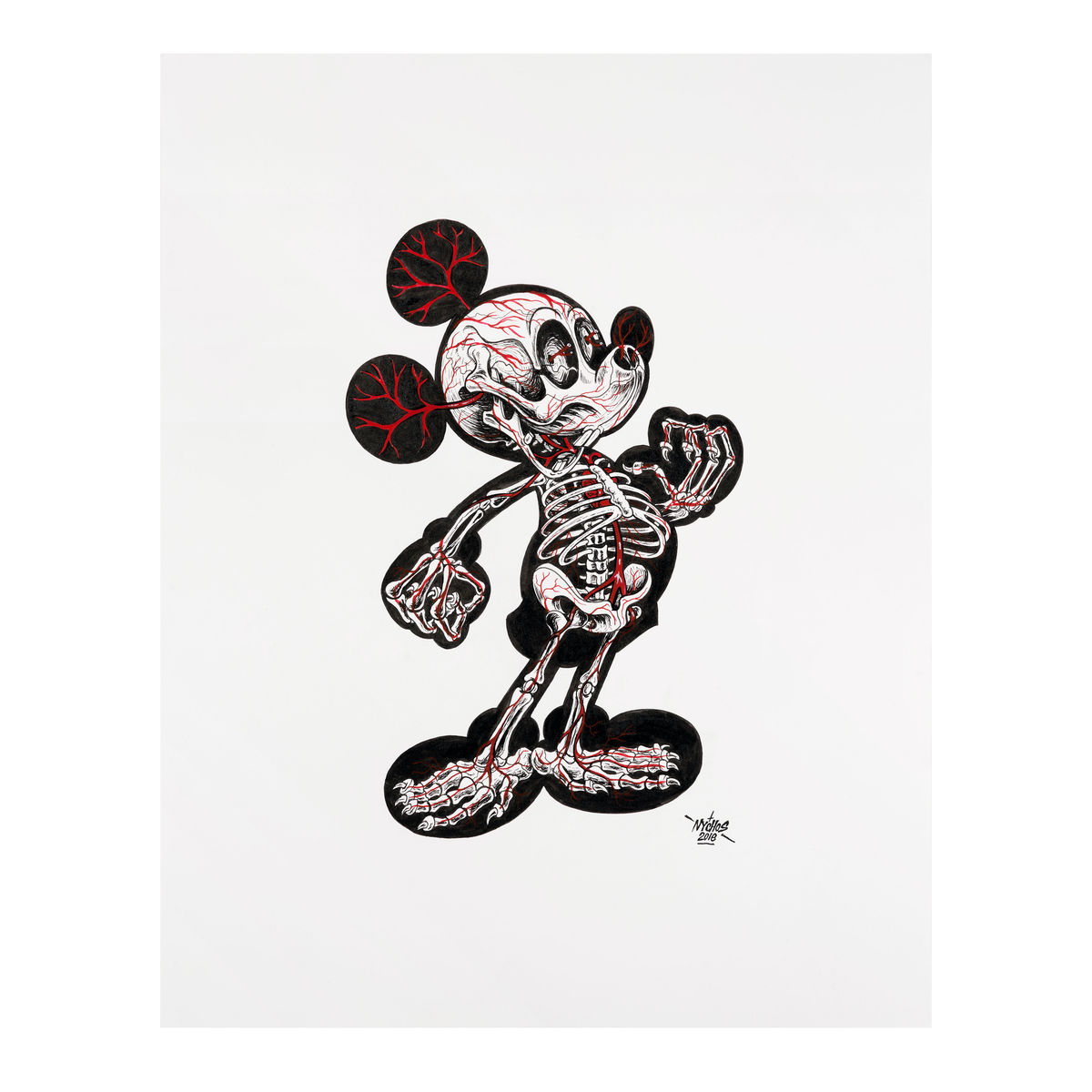 X-Ray of Mickey