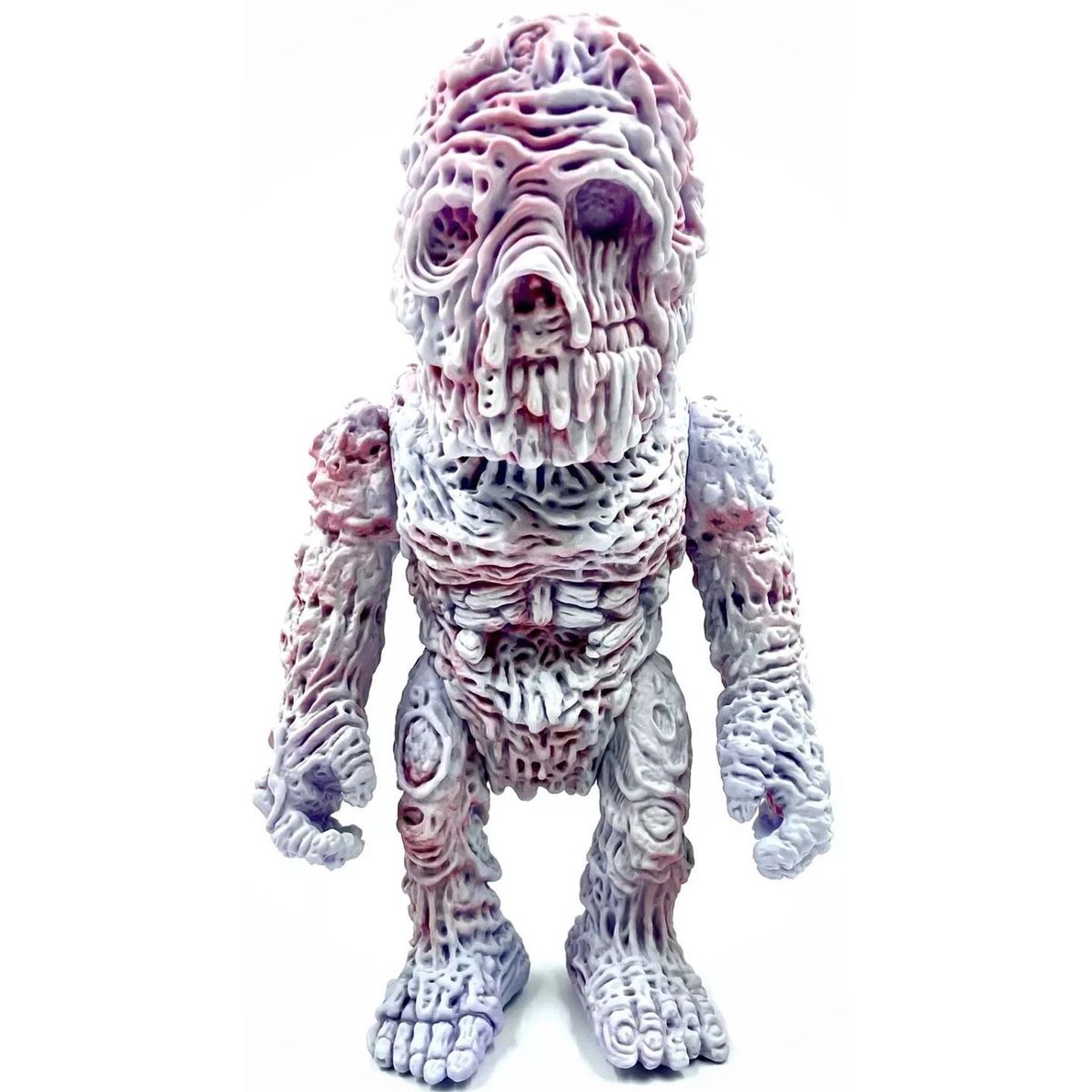 Frostbite Suffer