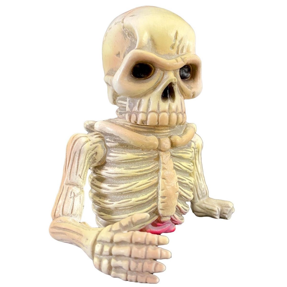 Broken Bones